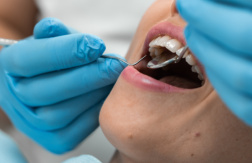 Desde $25: Servicios Dentales