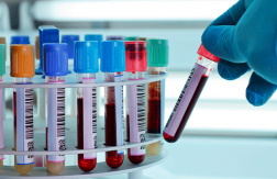 Paga $20: Exámenes de Laboratorio