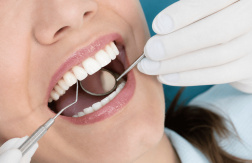 Desde $17.50: Servicios Dentales