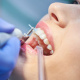 Paga $20: Limpieza Dental thumbnail 1