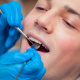 Desde $30: Servicios Dentales thumbnail 5
