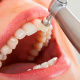 Desde $20: Servicios Dentales thumbnail 3