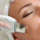 Desde $18: Limpieza Facial con Peeling o Radiofrecuencia thumbnail 1