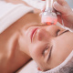 Desde $18: Limpieza Facial con Peeling o Radiofrecuencia thumbnail 2