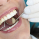 Desde $17.50: Servicios Dentales thumbnail 1