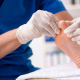 Desde $20: Pedicure Médico thumbnail 2