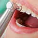 Desde $15: Servicios Dentales thumbnail 1