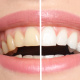 Desde $15: Servicios Dentales thumbnail 2
