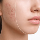 Desde $22.50: Faciales thumbnail 2