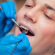 Desde $30: Servicios Dentales thumbnail 5