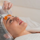 Paga $25: Peeling Facial thumbnail 1