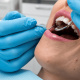 Desde $25: Servicios Dentales thumbnail 1