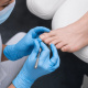 Desde $20: Pedicure Médico thumbnail 1