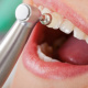 Desde $15: Servicios Dentales thumbnail 1