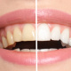 Desde $15: Servicios Dentales thumbnail 2