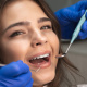Desde $15: Servicios Dentales thumbnail 3