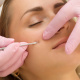 Desde $17: Limpieza Facial Profunda o Dermapen thumbnail 3