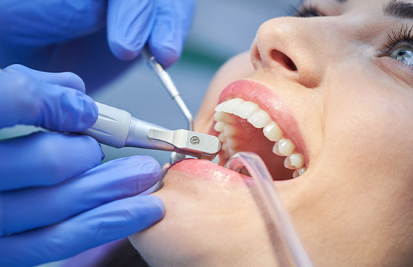 Desde $15: Servicios Dentales