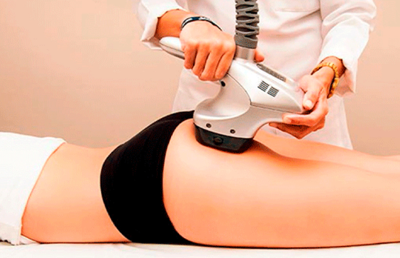 Desde $20: Circuito Reductor