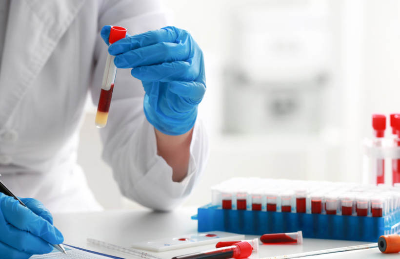 Desde $20: Exámenes de Laboratorio