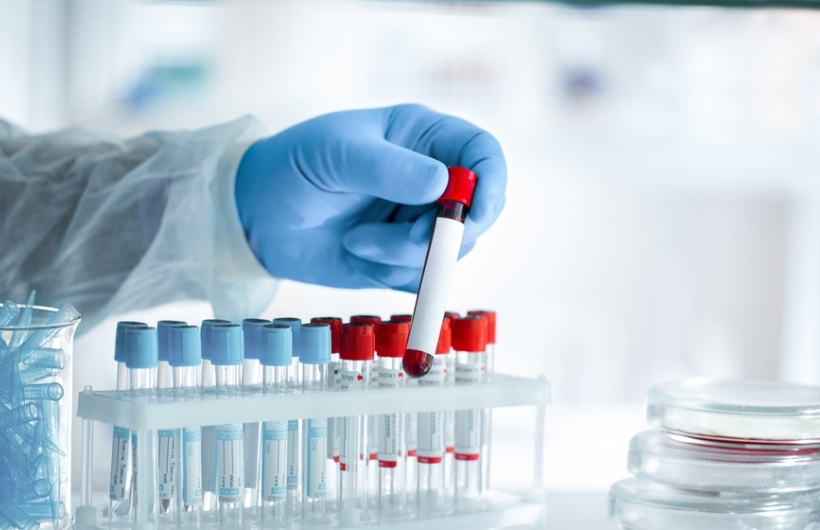 Desde $20: Exámenes de Laboratorio