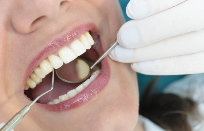 Desde $17.50: Servicios Dentales