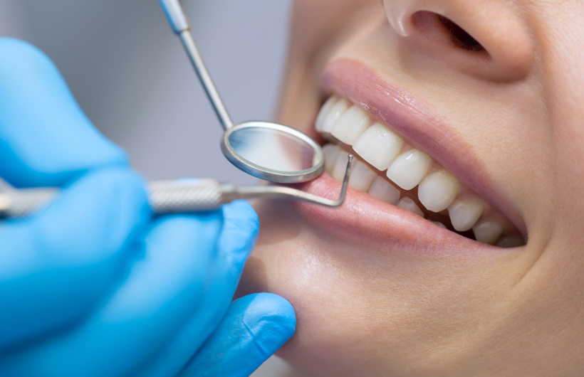 Paga $26: Servicios Dentales