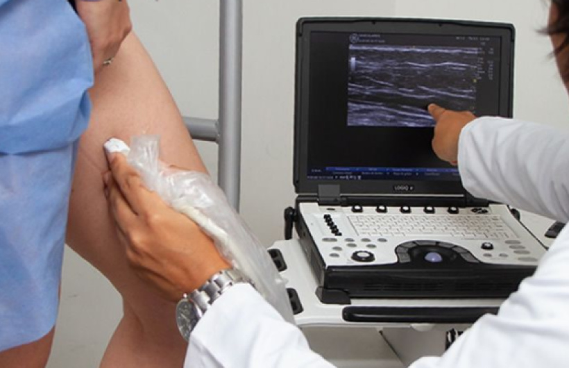 Desde $234: Ultrasonido Doppler