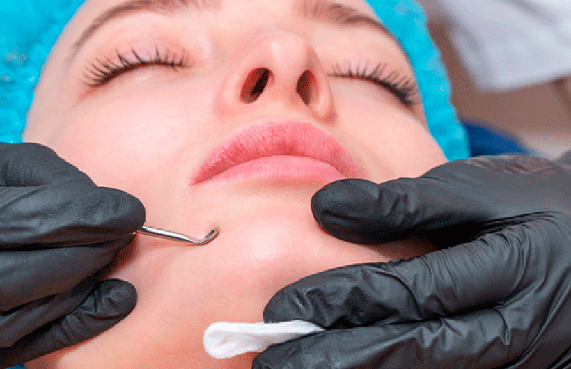 Desde $22: Tratamientos Faciales