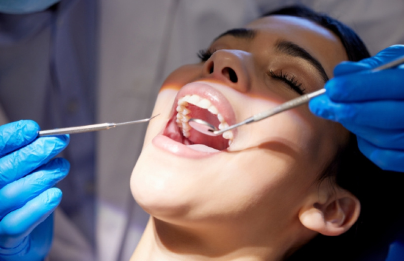 Desde $15.75: Limpieza Dental