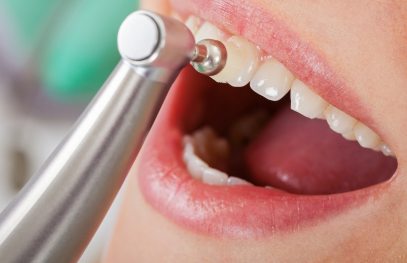 Desde $15: Servicios Dentales