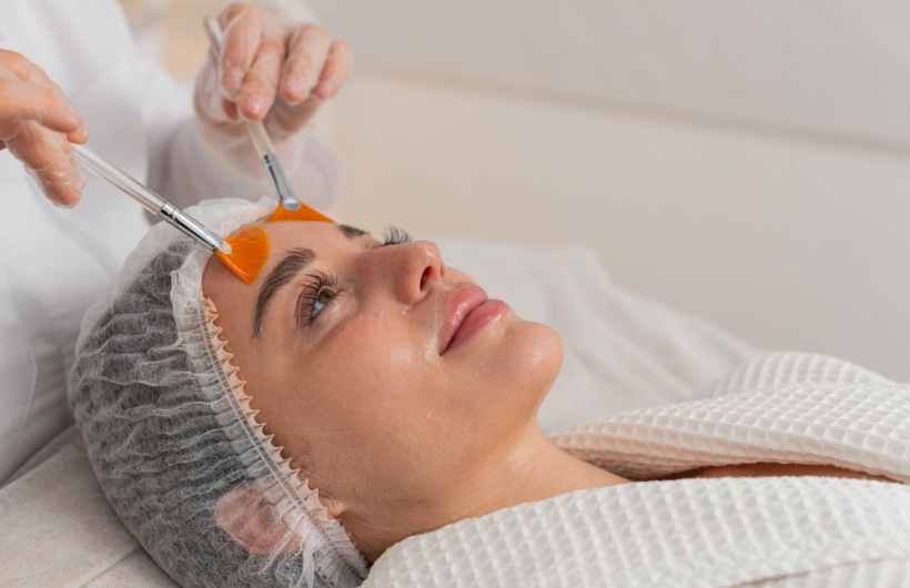 Desde $35: Facial Peeling