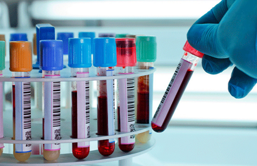 Paga $20: Exámenes de Laboratorio