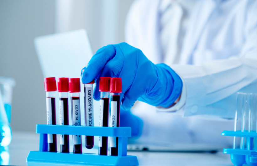 Paga $20: Exámenes de Laboratorio