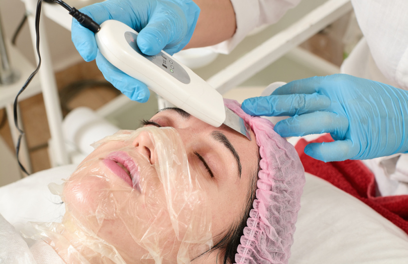 Paga $25: Peeling Facial
