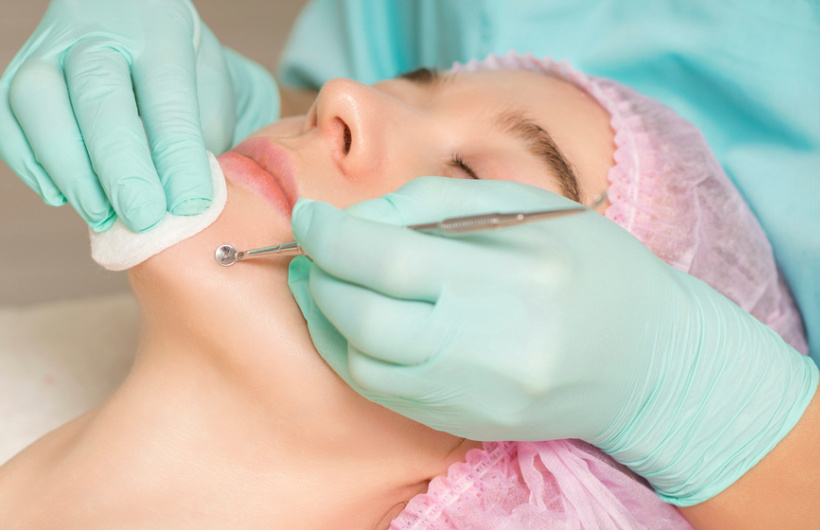 Paga $20: Hydrafacial con Máquina
