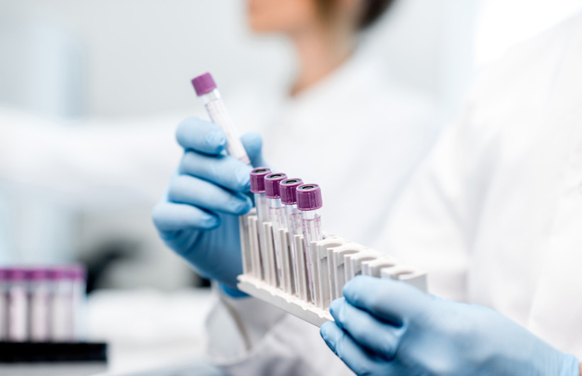 Paga $20: Exámenes de Laboratorio
