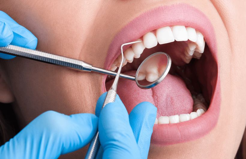 Desde $19: Servicios Dentales