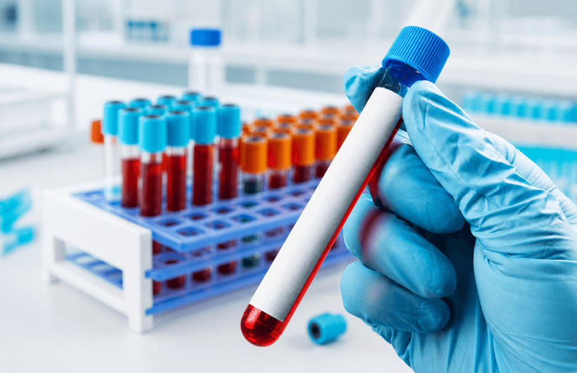 Paga $18: Exámenes de Laboratorio