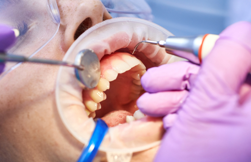 Desde $24.99: Servicios Dentales