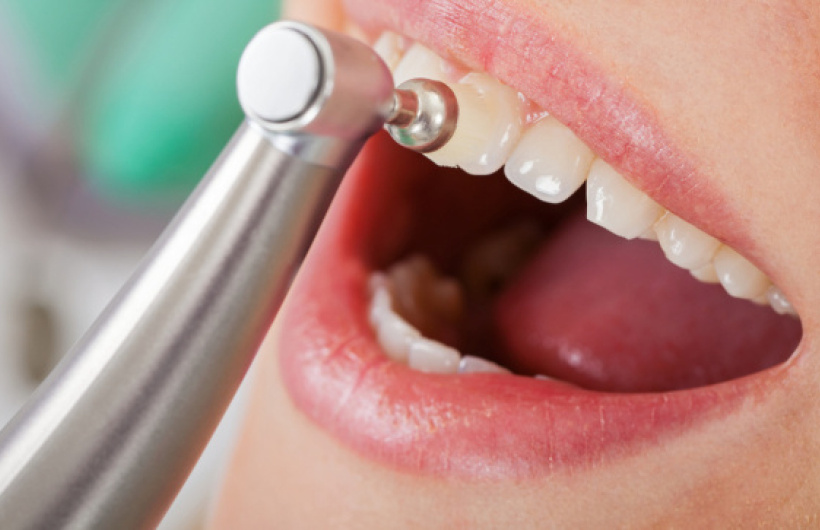 Desde $15: Servicios Dentales