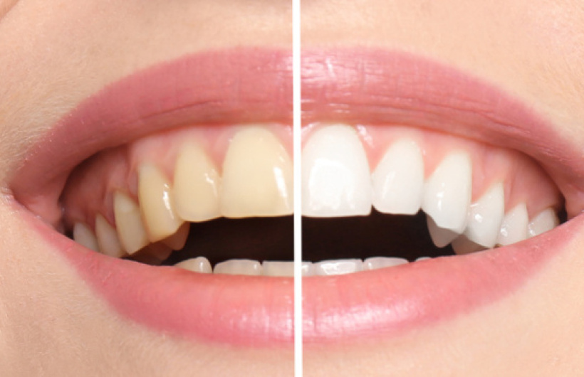 Desde $15: Servicios Dentales