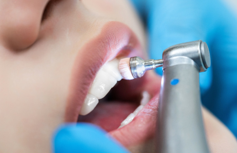 Paga $25: Limpieza Dental Profunda