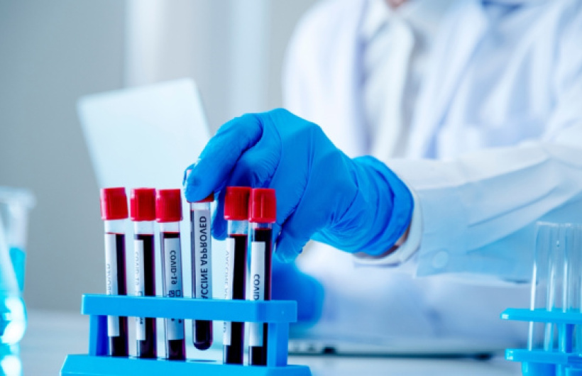Desde $28: Exámenes de Laboratorio